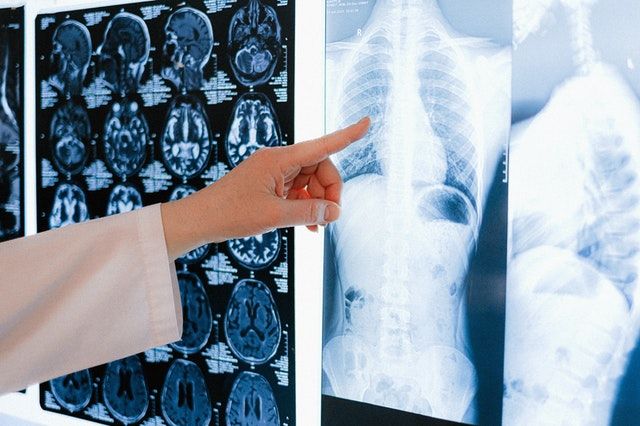 artificial-intelligence-ai-for-disease-diagnosis